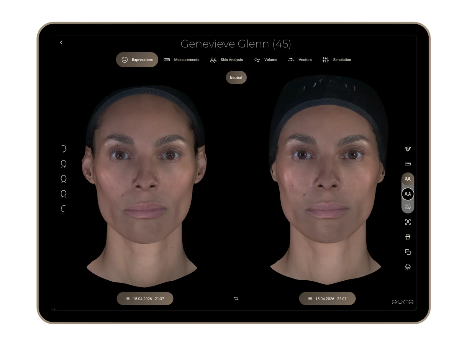 Aura Reality interface comparing two facial captures over time