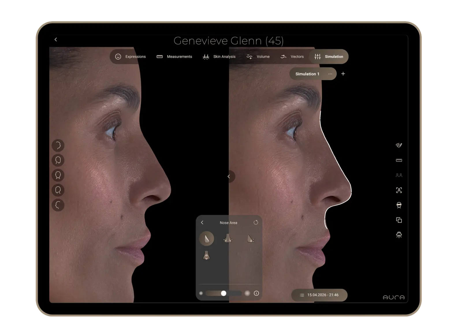 Aura Reality interface showing an illustrative facial treatment simulation