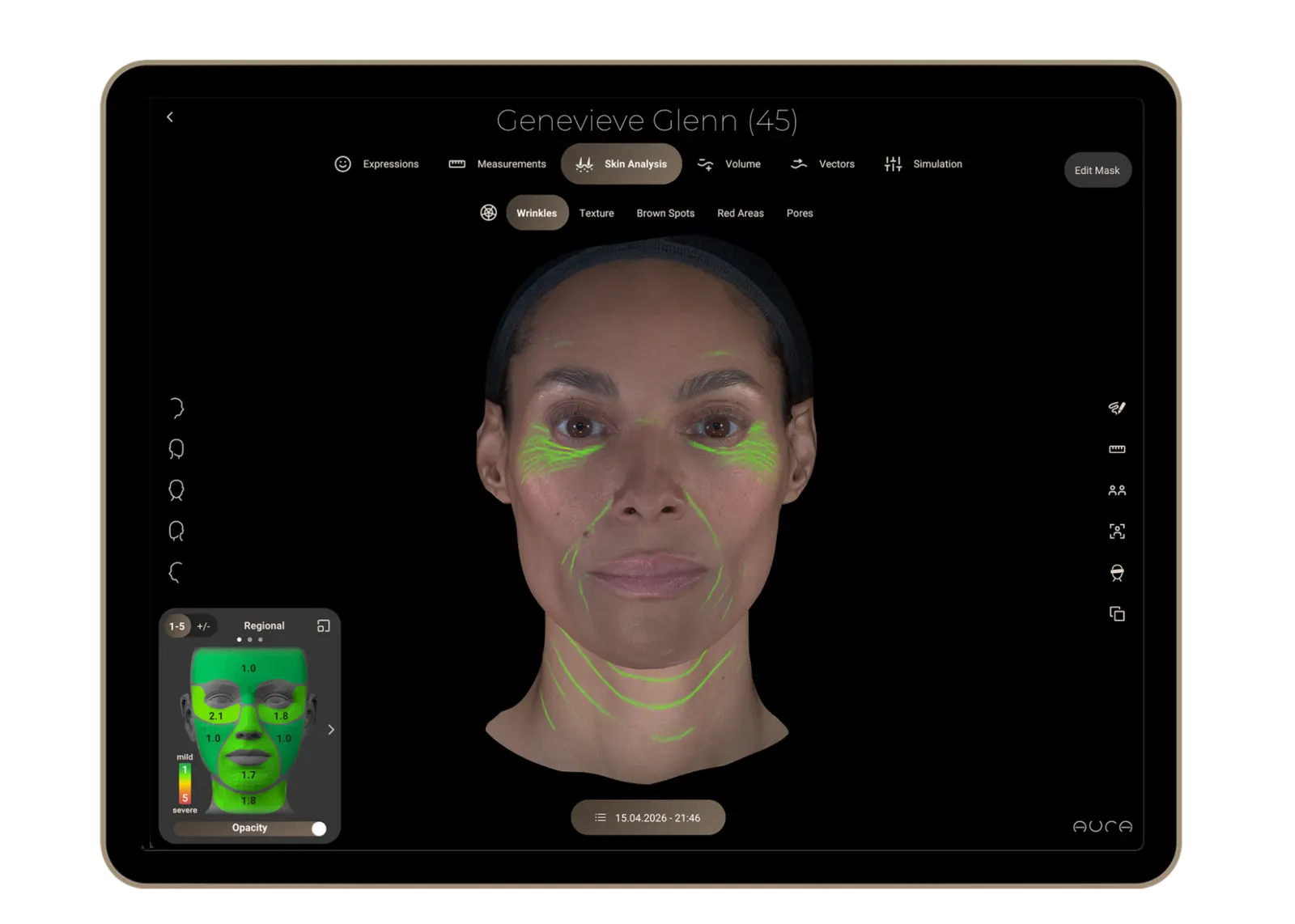 Aura Reality skin analysis interface visualizing facial skin characteristics