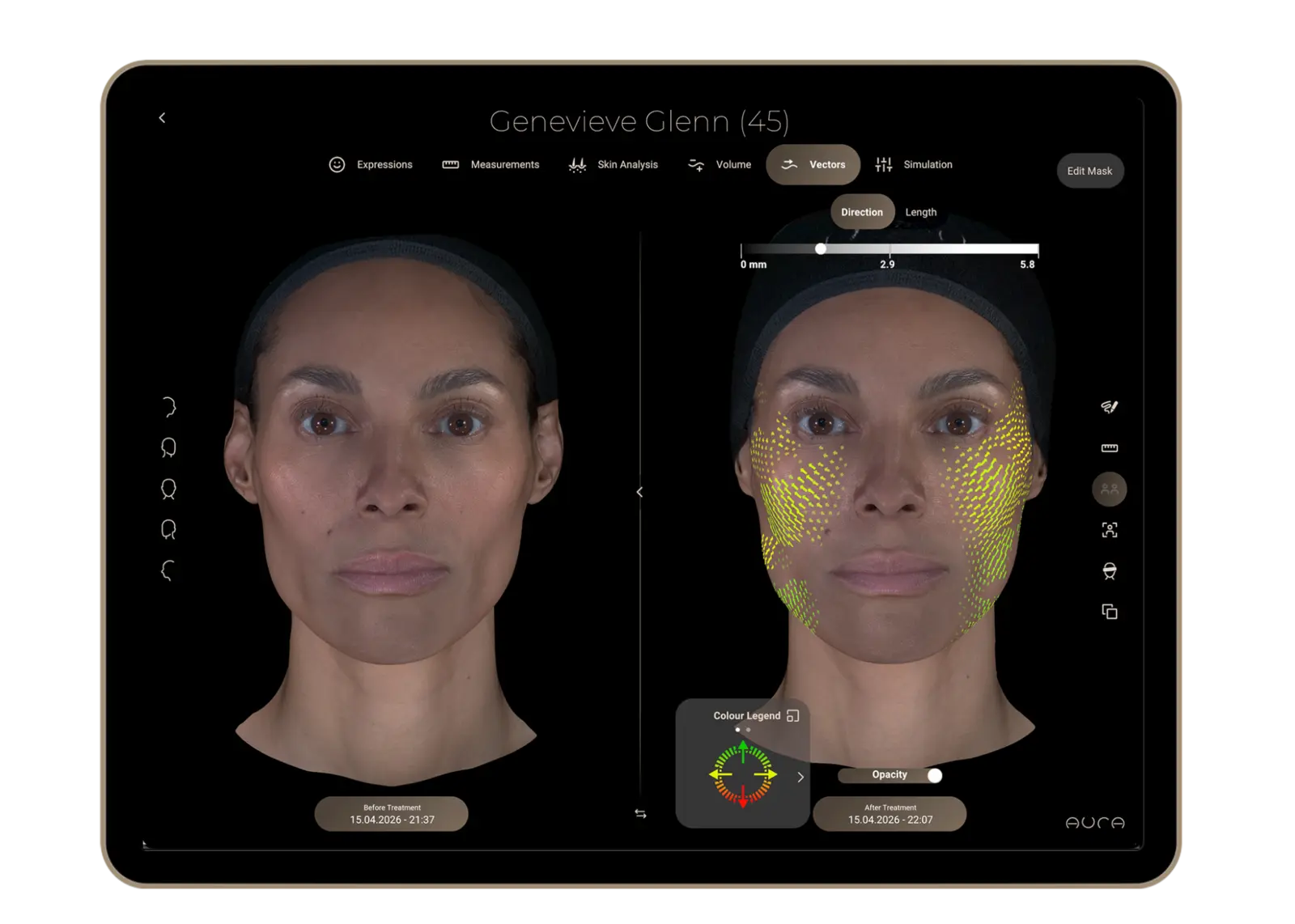 Aura Reality interface using vectors to compare facial volume change