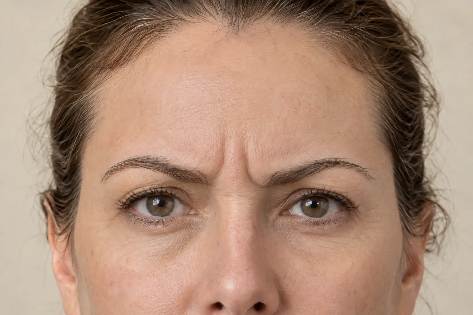 The same woman's upper face while frowning, showing natural movement between the brows