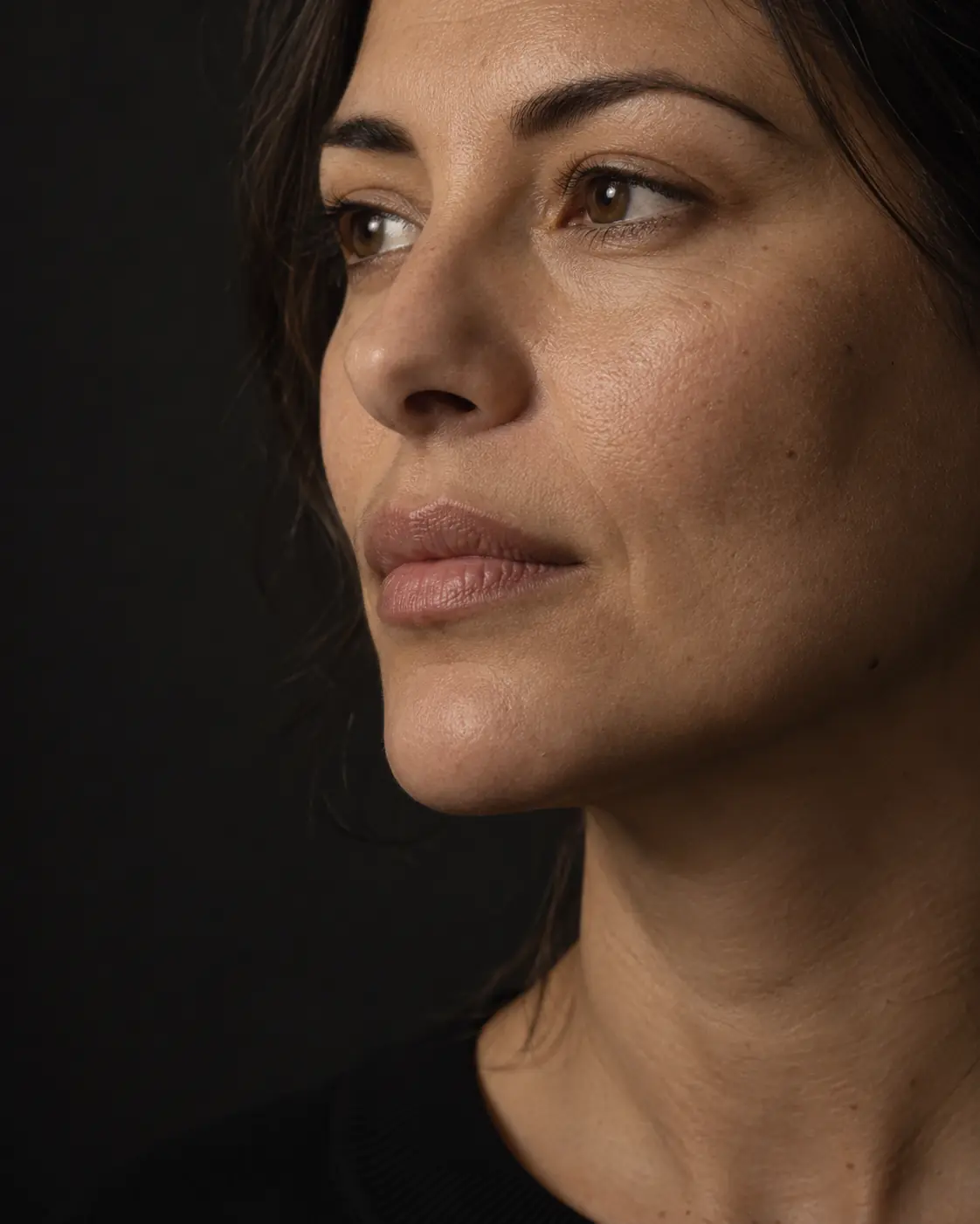 Illustrative three-quarter facial study used to explain how filler correction begins with observation and treatment history