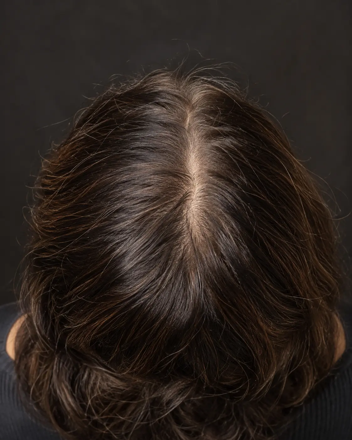Overhead view of a natural hair part used to illustrate consistent scalp documentation